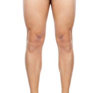 Depilación Láser Piernas completas Hombre