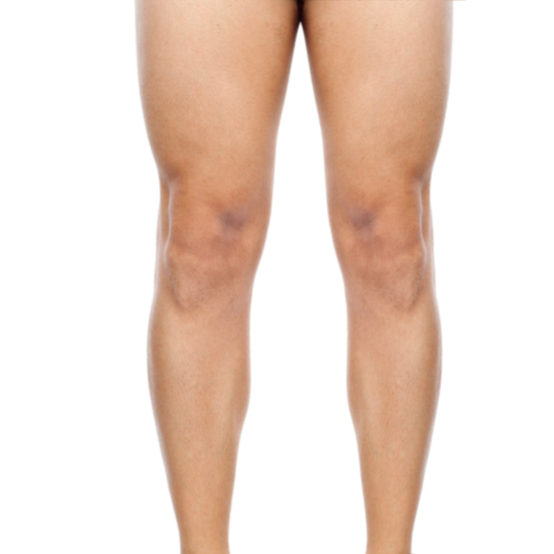 laser hombre piernas